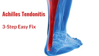 Achilles Tendonitis Fix in 3 Simple Steps [upl. by Laitselec]