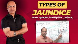 Types Of Jaundice  Causes Symptoms amp Treatment  Dr Najeeb [upl. by Burrus]