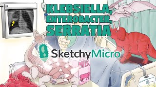 Klebsiella Enterobacter Serratia  SketchyMicro  Sketchy Medical USMLE Step 1 [upl. by Casta262]