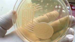 Klebsiella pneumoniae [upl. by Richelle]