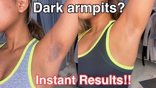 How To Get Rid Of Dark Armpits INSTANTLY 100 works [upl. by Saiasi898]