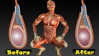 Varicocele exercise for men [upl. by Veejar321]