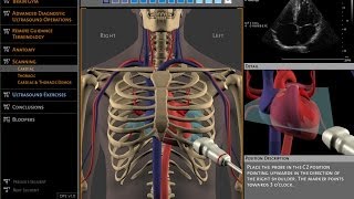 Basics of ultrasound machine [upl. by Almeeta]