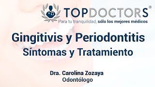 Gingivitis y Periodontitis Síntomas y Tratamiento [upl. by Adaval287]