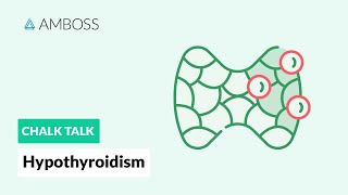 Hypothyroidism A Diagnostic Approach [upl. by Rhona212]