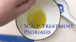 Scalp Treatment for Psoriasis [upl. by Gnihc80]