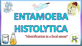 Entamoeba Histolytica  Morphology of the Trophozoite amp Cyst on Light Microscope Stools for AOC [upl. by Aineval501]