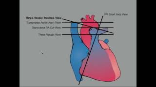 Advanced Evaluation of the Fetal Heart [upl. by Eerok]