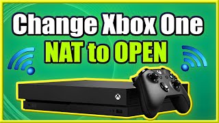 How to Change Xbox One NAT to OPEN and FIX Strict Connection Issues Easy Method [upl. by Trilly]