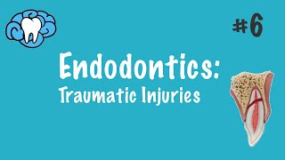 Endodontics  Traumatic Injuries  INBDE ADAT [upl. by Algernon135]