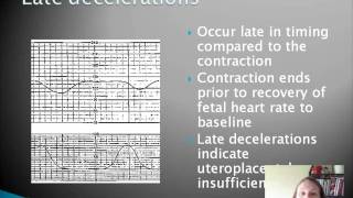 Basic Fetal Heart Rate Monitoring [upl. by Lamoree]