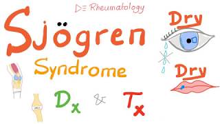 Sjögren Syndrome Diagnosis and Management [upl. by Atiuqihc654]