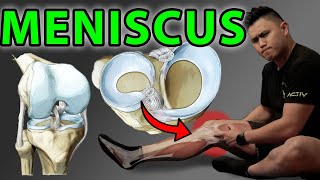 Will a meniscus tear heal itself without surgery [upl. by Nahum686]