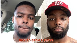 How to Grow a Beard  UPDATE Minoxidil [upl. by Cailly726]