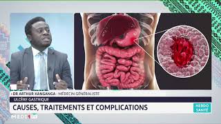 Ulcère gastrique causes traitements et complications [upl. by Rotman]