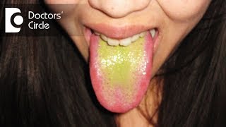 Oral Hairy LeukoplakiaExplained by a Dermatopathologist [upl. by Nij11]