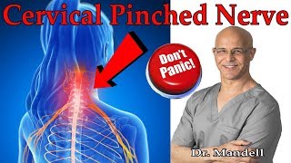 How to Overcome Cervical Pinched Nerve amp Radiculopathy Dont Panic  Dr Alan Mandell DC [upl. by Eenoj]