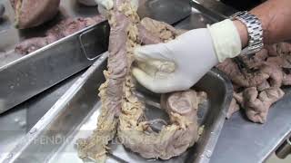 Anatomy Dissection of Large amp Small Intestine [upl. by Bred]