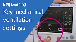 Key settings for a mechanical ventilator  BMJ Learning [upl. by Llerraf]