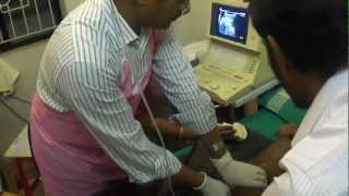 intussusception by Dr K M Abul Hasan [upl. by Ramses438]