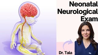 How to perform the NEURO exam on a baby HeadtoToe CNS evaluation [upl. by Costanzia]