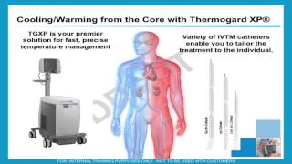 Hypothermia for acute treatment of ischemic stroke by Patrick Lyden MD [upl. by Keung700]