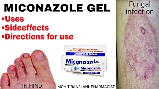 Miconazole nitrate cream  Uses sideeffects directions  Fungal infection treatment in Hindi [upl. by Ajtak595]