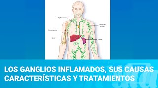 Los ganglios inflamados sus causas características y tratamientos [upl. by Agni713]