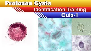 Protozoa Cysts Identification Training Quiz  Part 1 [upl. by Nora]