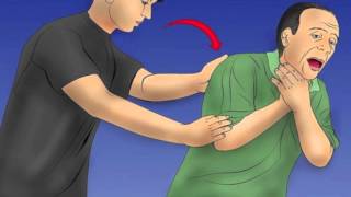 How to do the Heimlich Maneuver [upl. by Gruber]