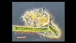 Amoeba eats paramecia  Amoebas lunch   Amoeba Endocytosis  Phagocytosis Part 1  👌 [upl. by Vladi]