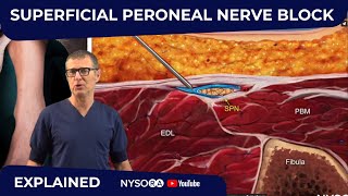 Superficial Peroneal Nerve Block  Crash course with Dr Hadzic [upl. by Signe]