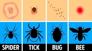 How to Identify a Bug Bite and What to Do With It [upl. by Adnawed]