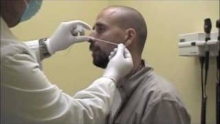 Procedure for Nasopharyngeal Swabs and Aspirates [upl. by Euqnimod]