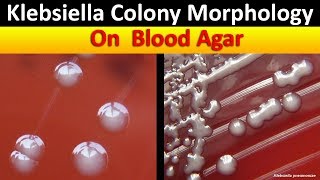 Klebsiella Colony Morphology On Blood Agar [upl. by Yesnyl]