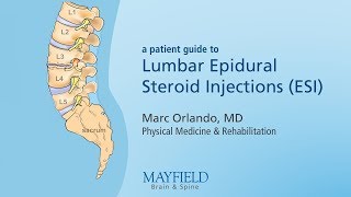 Lumbar Epidural Steroid Injections [upl. by Roth]