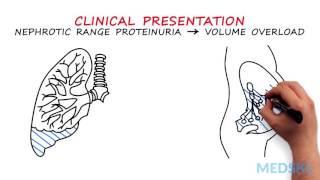 Nephrology – Proteinuria By Manish Suneja MD [upl. by Tigdirb560]