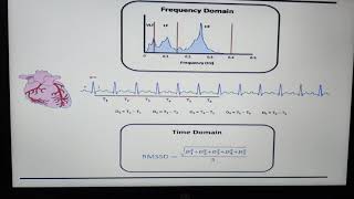 Heart rate variability by Dr Ritu Tiwari MBBDS MDFISC [upl. by Anifad]