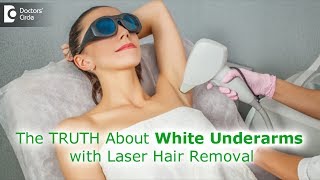 Myth or Fact Can laser hair removal procedure whiten underarmsDr Rashmi RavindraDoctors Circle [upl. by Nnylav]