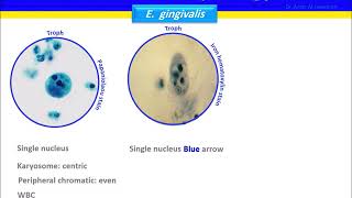 Entamoeba gingivalis [upl. by Veradia655]