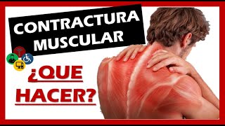 ¿Qué es una contractura [upl. by Acirdna]