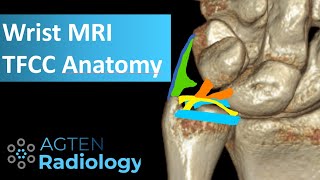 MRI Anatomy of TFCC [upl. by Elmira953]