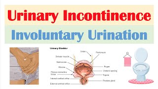 Urinary Incontinence Stress Urge Overflow amp Functional  Causes Symptoms Diagnosis Treatment [upl. by Stargell]