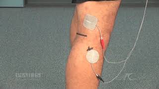 Flexion Reflex Option 1 Electrode Placement for Muscle Stimulation [upl. by Sivart220]