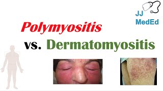 Idiopathic Inflammatory Myopathies  Polymyositis vs Dermatomyositis [upl. by Akoyn]