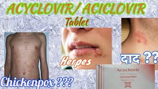 Acyclovir tablets  Herpikind  Herpikind Tablet  Zovirax  Zovirax tablets  uses side effects [upl. by Tigges1]