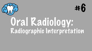 Oral Radiology  Radiographic Interpretation  INBDE ADAT [upl. by Asante110]