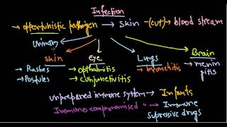 Pseudomonas aeruginosa infection [upl. by Yelrac]