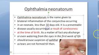 Ophthalmology Neonatal Conjunctivitis Ophthalmia Neonatorum Causes Eye Discharge in Baby Newborn [upl. by Kiefer847]