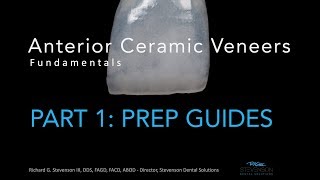 Anterior Ceramic Veneers Part 1 Preparation Guides [upl. by Engvall]